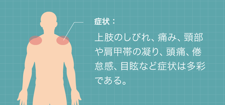 上肢のしびれ、痛み、頸部や肩甲帯の凝り、頭痛、倦怠感、目眩など症状は多彩である。