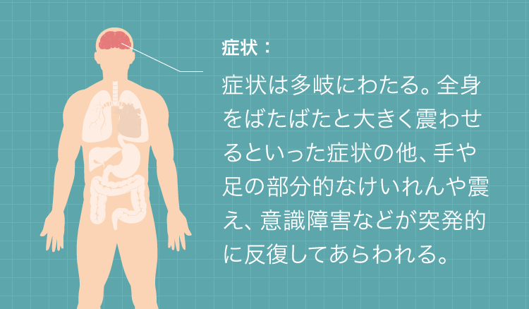 症状は多岐にわたる。全身をばたばたと大きく震わせるといった症状の他、手や足の部分的なけいれんや震え、意識障害などが突発的に反復してあらわれる。